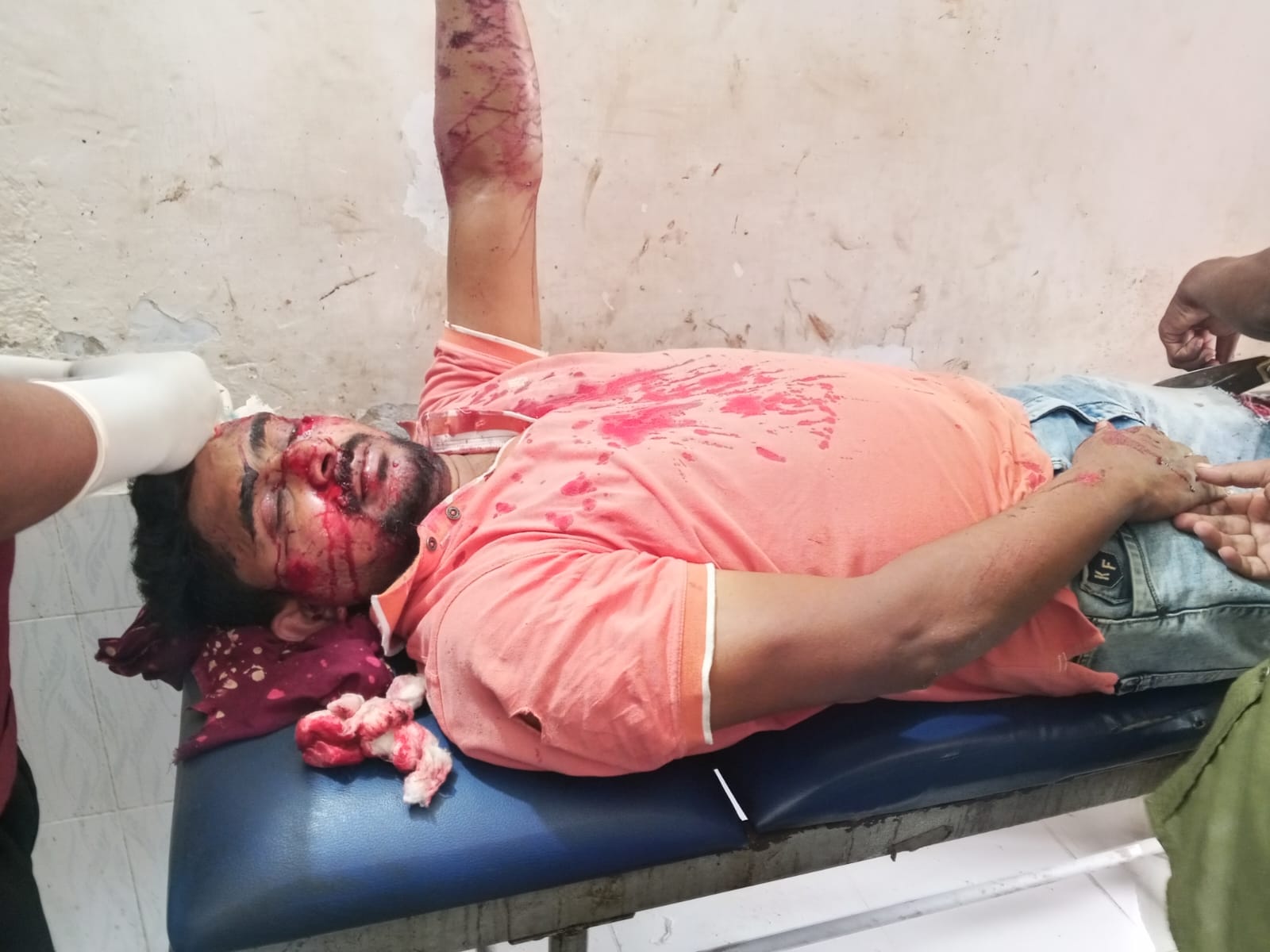 নেকমরদ-রাণীশংকৈল সড়কে কুকুরের সঙ্গে মোটরসাইকেলের সংঘর্ষ, গুরুতর আহত ২ জন।